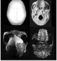 Left: This image shows upper and lower views of cranium OH5 (<i>Paranthropus boisei</i>). Right: Same views of <i>Homo sapiens</i> cranium.