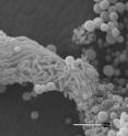Scanning electron micrograph shows infectious spores produced by the deadly fungi <i>Cryptococcus neoformans</i>.