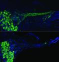 This shows regenerated auditory nerves after gene therapy (top) compared with no treatment (below).