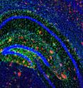 Amyloid plaques (shown in red) dot the brain of a mouse model of Alzheimer's disease. Scientists have found that an antidepressant can reduce production of the primary component in these plaques.