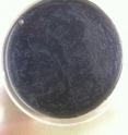 This image shows <em>Legionella</em> colonies growing on petri dish