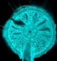 This is a cross section of a rice root showing the development of a root branch towards water. The photo is credited to Pooja Aggarwal.
