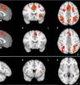 This image shows functional MRI imaging during mental task switching: Panels A and B shows brain activation in musically trained and untrained children, respectively. Panel C shows brain areas that are more active in musically trained than musically untrained children.