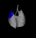 This is a microCT reconstruction of sox2/lkb1 mouse lung with tumor in blue.