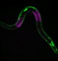This shows the nematode worm <i>C. elegans</i> with muscle cells fluorescently labeled in green and germ cells fluorescently labeled in red. These cells and others pause at a checkpoint in development and slow their aging when worms encounter a period of starvation.