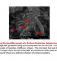 This is a scanning electron micrograph of a culture containing <i>Dehalococcoides</i>.