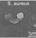 This image depicts destructive electron extraction from bacterial membranes by plasmonic gold nanoparticles.