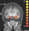 Brain image shows increased activity in the amygdala, the portion of the brain involved with emotion, when intentionally harmful acts were described vividly than when they were described matter-of-factly.