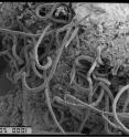 The researchers examined the relationship between each sheep's body weight and its level of infection by nematodes, tiny parasitic worms that thrive in the gastrointestinal tract of sheep. This scanning electron micrograph shows nematodes on the surface of a sheep's gut with a field of view of approximately one centimeter. An economic detriment to sheep farmers, nematodes infect both wild and domesticated sheep, resulting in weight loss, reduced wool growth and death.
