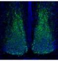 A peptide responsible for cell communication in the brain, Vip (green) is reduced in the brains of mice that have little or no Lhx1 (right).