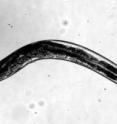 This is a nematode from the Rice lab of biochemist Weiwei Zhong. Nematodes are favorite models of biological systems for their relative simplicity, their transparency and the ease with which scientists can manipulate their genetic sequences.