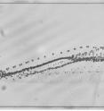 This image shows the beginning of separation stream separating cancer cells from red blood cells in the tilted-angle standing surface acoustic wave-based cell-separation device.