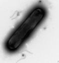 This is an image of <i>Clostridium difficile</i> or <i>C-diff</i>.