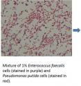 University of Hawaii at Manoa College of Engineering mechanical engineer Yi Zuo has developed a new, high-throughput method for sorting cells capable of separating 10 billion bacterial cells in 30 minutes.