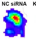 Using bioluminescence, researchers showed that the novel molecule 'KRAS silencing RNA' or 'KRAS siRNA' (right) reduced the size of a tumor in mice. Researchers used a 'non-KRAS silencing' molecule as the control (left) as a comparison.