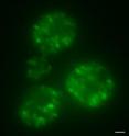 The fluorescent green chunks in these yeast cells are prion proteins that have assumed the shape that aggregates into clumps called amyloids. The prion proteins in these cells are tagged with a marker that fluoresces green under UV light.