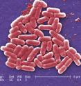 This is a cluster of colorized <i>E. coli</i> as seen under a scanning electron microscope.