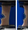 Sequence of images showing how skin when torn does not propagate but progressively yawns open under tensile loading.