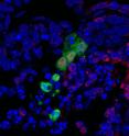 In this image, a novel type of human stem cells is shown in green integrating and developing into the surrounding cells of a nonviable mouse embryo. Red indicates cells of endoderm lineage. Endoderm cells can give rise to tissue that covers organs from the digestive and respiratory systems. The new stem cells, developed at the Salk Institute, holds promise for one day growing replacement functional cells and tissues.