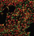 Neuronal progenitor cells differentiated from SCNT-ESC cells (Leigh-NT1 in paper).