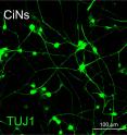 This is an image of mouse chemical-induced neurons.