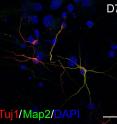 This is an image of human chemical induced neurons.