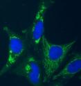 Cells whose fluorescent labeling reveals dot shaped or filamentous mitochondria (green), nuclei (blue) or the cytoplasm (greenish-black).