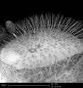 SEM images are of a hairs on a honeybee's eye.