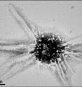 This is a cluster of gold nanoparticles (left), formed under exposure to ultraviolet light. The cluster can be disassembled (right), releasing molecules that were trapped in its nanoflasks. Viewed under a transmission electron microscope
