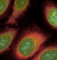 This is a composite image of HeLa cells stained sequentially with antibodies to five different proteins.