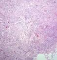 Tumour tissue from a mouse with lung cancer is shown.