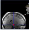 Why do we particularly remember the high points of experience? Using functional MRI, UC Davis neuroscientists were able to able to identify a signal in the hippocampus associated with a rewarding memory, in this case related to a photo of a basketball court.