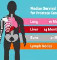 Median Survival for Prostate Cancer Metastases Site.