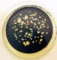 Image shows the growth of <em>Mycobacterium</em> isolated on a plate of culture medium. Image shows the growth of <em>Mycobacterium</em> isolated on a plate of culture medium.