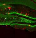 This image represents a coronal section of hippocampal dentate gyrus (DG) from a mouse model of early Alzheimer's disease. These AD mice exhibit severe &beta;-amyloid plaques (red) in the DG at 9-months of age. Using these mice combined with a novel viral strategy, memory engram cells (green) for a contextual fear memory were labeled.