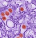 This is a transmission electron micrograph (TEM) of the Zika virus.