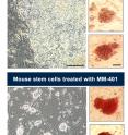 Mouse epiblast stem cells (top) have already begun the journey to differentiating into "adult" cells. But when the same kind of cells were treated with a drug called MM-401, they reverted to an 'embryonic' stem cell state.