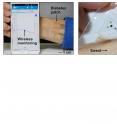 Figure 3_Demonstration of the wearable diabetes monitoring and therapy system in vivo.