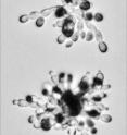 Colonies of yeast (<i>Saccharomyces cerevisiae</i>) pictured under a microscope. In glucose-rich conditions (inset), yeast cells grow in a tight cluster. But when glucose is limited (main image), new cells grow outward, forming a filament-like configuration that may aid in the search for food. A new study identifies the cellular mechanisms that cause the change in growth pattern, as well as the amount of time it takes for the shift to occur.  Bar, 10 microns.