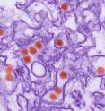 This is a transmission electron micrograph image of the Zika virus.