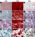 In this figure, Alizarin Red S calcium staining shows how all nonwoven fabrics types were evaluated as tissue engineering scaffolds. Calcium deposits appear dark red after staining and all fabric types exhibited the presence of intense calcium staining when treated indicating the presence of viable cells.