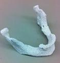This is a sample 3-D printed scaffold that matches the lower jaw of a female patient.