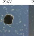 This image shows the effects of a TLR inhibitor on a Zika-infected brain organoid.