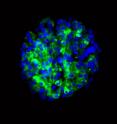 Researchers have produced insulin-secreting cells from stem cells derived from the skin of patients with type 1 diabetes. The cells (blue), made from stem cells, can secrete insulin (green) in response to glucose.