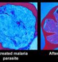 Massive morphological changes resembling premature onset of parasite division in malaria parasites after two-hour exposure to new antimalarial drugs.