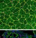 When the researchers shut off the expression of laminin (red) in pericyte and PIC stem cells, the affected mice (right) showed a dramatic alteration in muscle fiber maturation (green), as is seen in muscular dystrophy patients. Normal mouse muscle appears on the left.