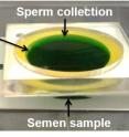 The device developed at FAU consists of one inlet for the injection of a raw unprocessed semen sample and two plastic chambers separated by porous membrane. The most healthy and motile sperm swim through the porous membrane leaving behind less functional and dead sperm in the bottom chamber. Using this sorting technology, a technician just has to inject the semen sample into the device and can then collect healthy sperm from the top chamber in about 30 minutes, making it very easy to use.