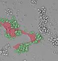 A microscope photograph showing immune cells (green) attacking tumor cells (red).