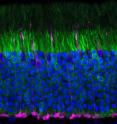 This image shows a section of a mouse retina showing rod photoreceptors (green) and cone photoreceptors (magenta). Cell nuclei are stained in blue.