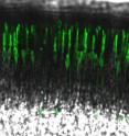 This image shows cone photoreceptors (green) in a slice from a mouse retina. A majority of the photoreceptors (97%) in the retina are rods (black). The black layer on top of the photoreceptors is retinal pigment epithelium.